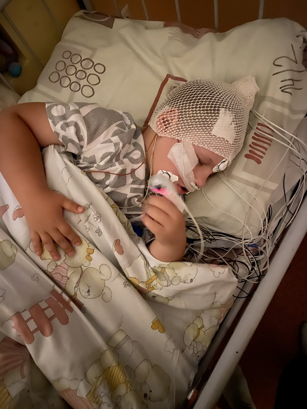Leuško spí počas nočného EEG monitoringu so senzormi na hlave